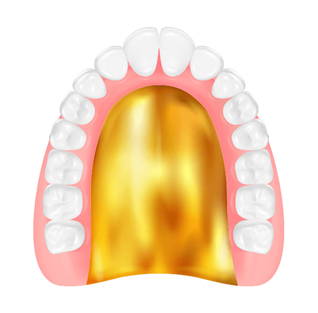 ゴールド床義歯