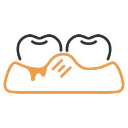 歯周病治療・予防歯科